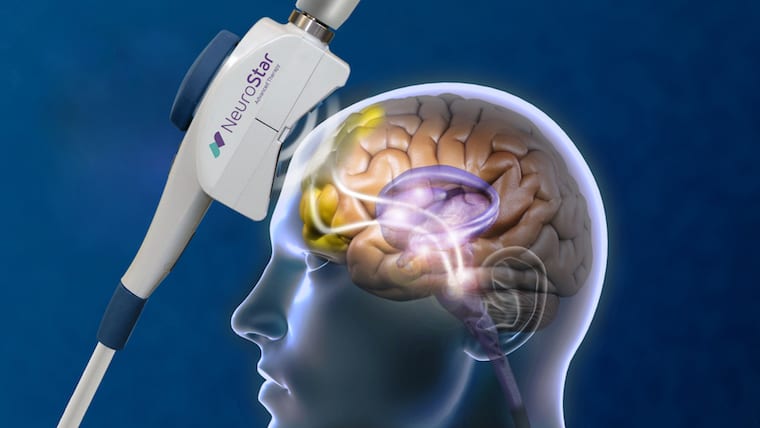 TMS therapy targeting brain