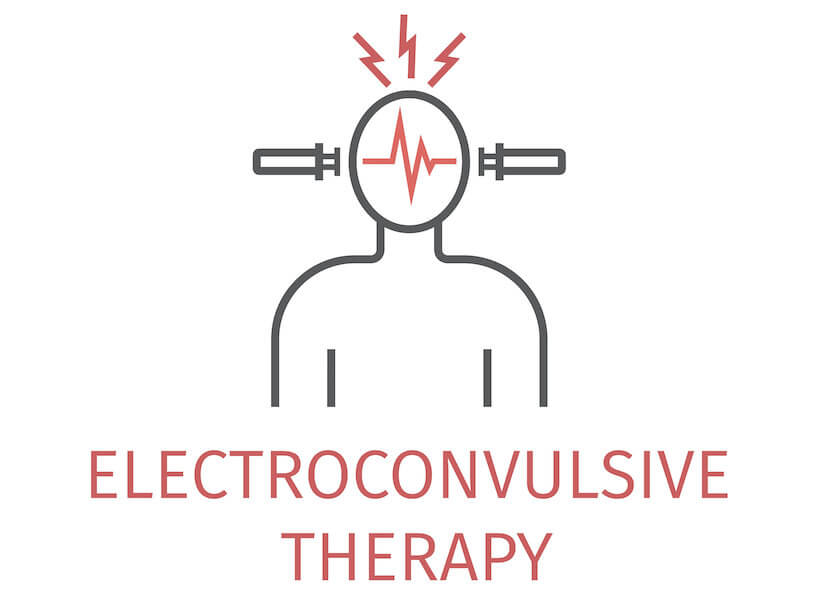 ect electroconvulsive therapy